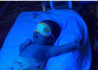 Фото: Прокат фитоламп для личения желтушки у новорожденн