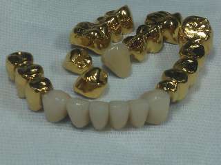 Фото: Установки  покрытия зубных протезов  "под золото"