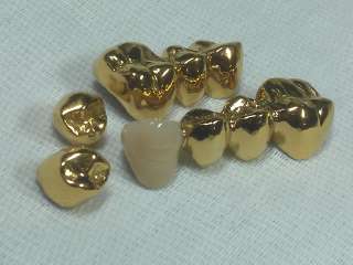 Фото: Установки  покрытия зубных протезов  "под золото"