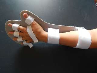 Фото: Фиксатор для руки после инсульта, травмы