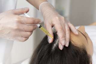 Объявление с Фото - Лечение алопеции выпадения волос