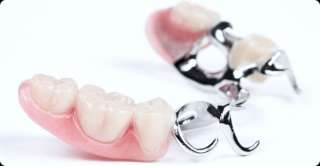 Объявление с Фото - Бюгельное протезирование зубов
