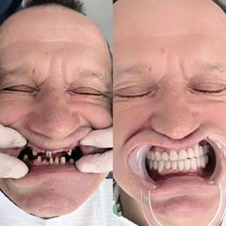 Фото: Лечение и протезирование зубов в городе Хэйхэ